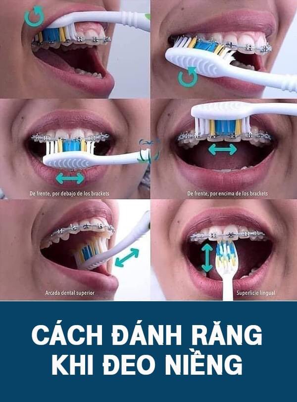 Chăm sóc răng miệng đúng cách 1 Chăm sóc răng miệng đúng cách 1