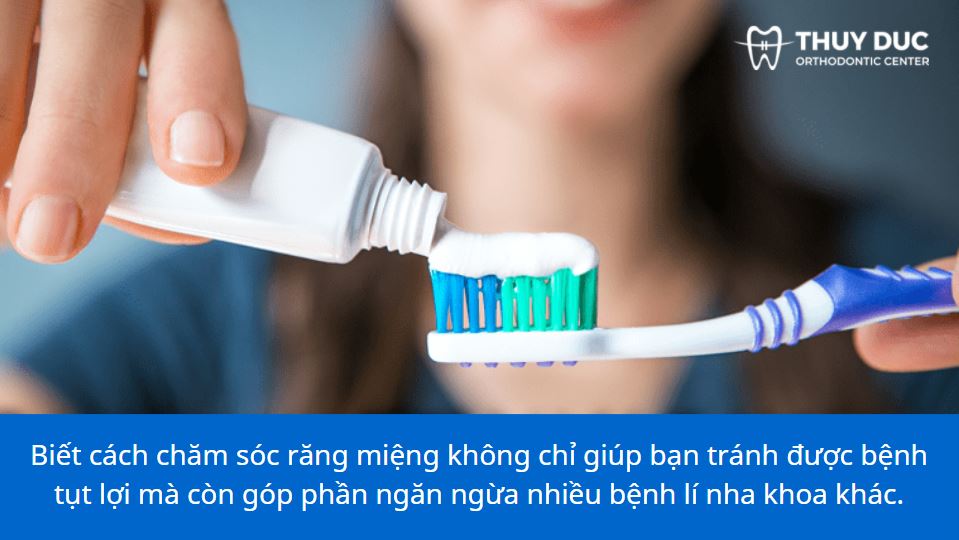 Bạn nên làm gì để ngăn chặn tụt lợi khi niềng răng? 1 Bạn nên làm gì để ngăn chặn tụt lợi khi niềng răng? 1