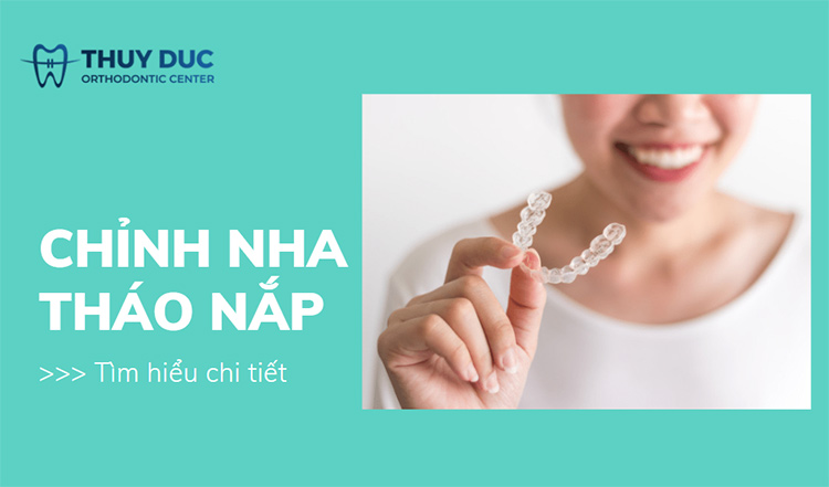 Chỉnh nha tháo lắp là gì? Phù hợp với đối tượng nào? 1 Chỉnh nha tháo lắp là gì? Phù hợp với đối tượng nào? 1