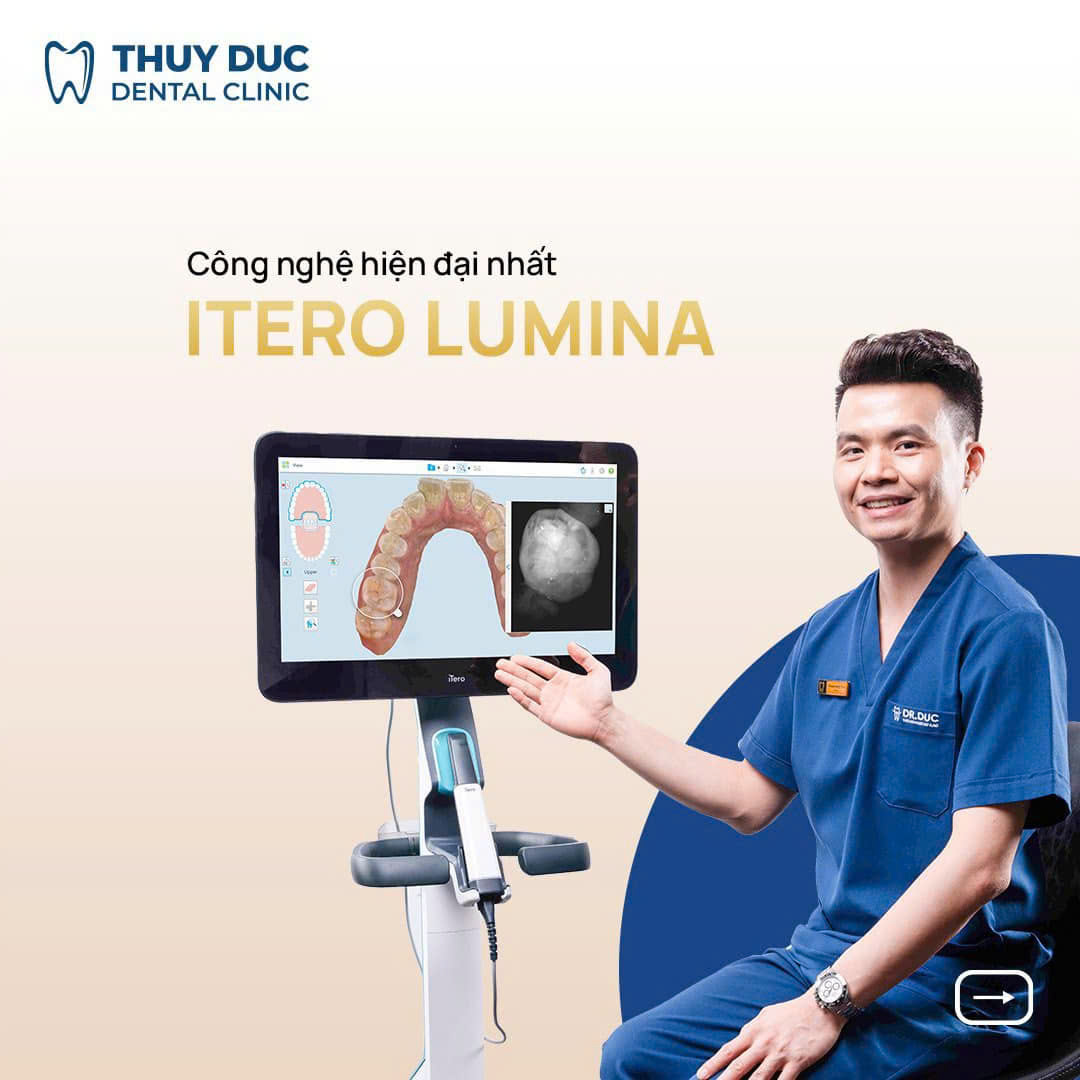 Ưu điểm của niềng răng trong suốt Invisalign 1 Ưu điểm của niềng răng trong suốt Invisalign 1