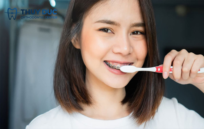 Những yếu tố tác động đến hiệu quả niềng răng 1 Những yếu tố tác động đến hiệu quả niềng răng 1