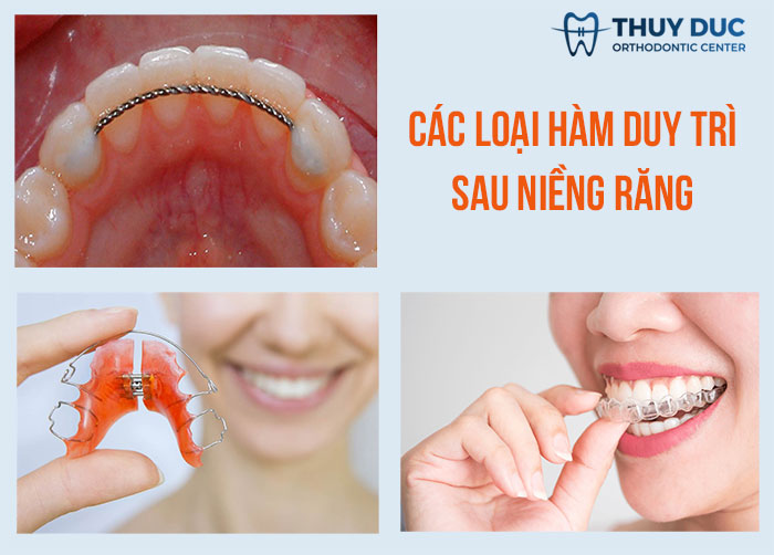 7. Tìm Hiểu Về Các Dịch Vụ Chỉnh Nha Uy Tín