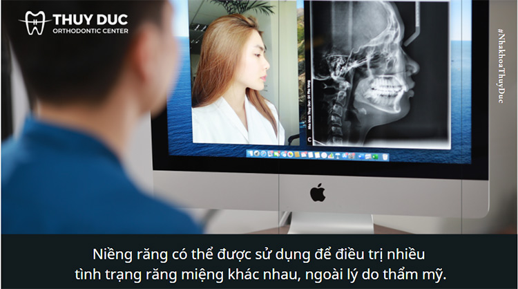 1. Bạn có nên niềng răng hay không? 2 1. Bạn có nên niềng răng hay không? 2