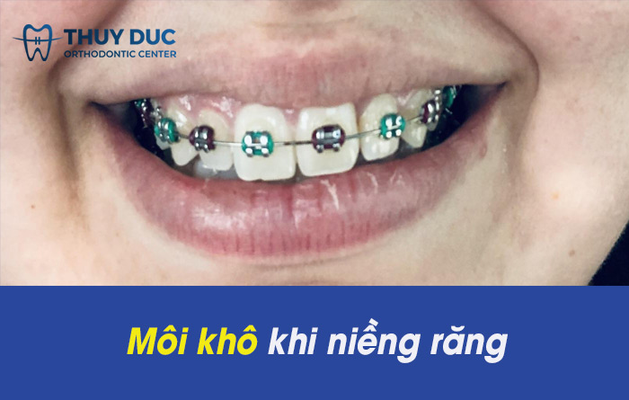 Các mô mềm trong miệng dễ bị tổn thương 1