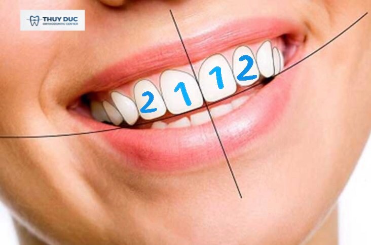 Tìm hiểu về răng cửa và chức năng của nó 1