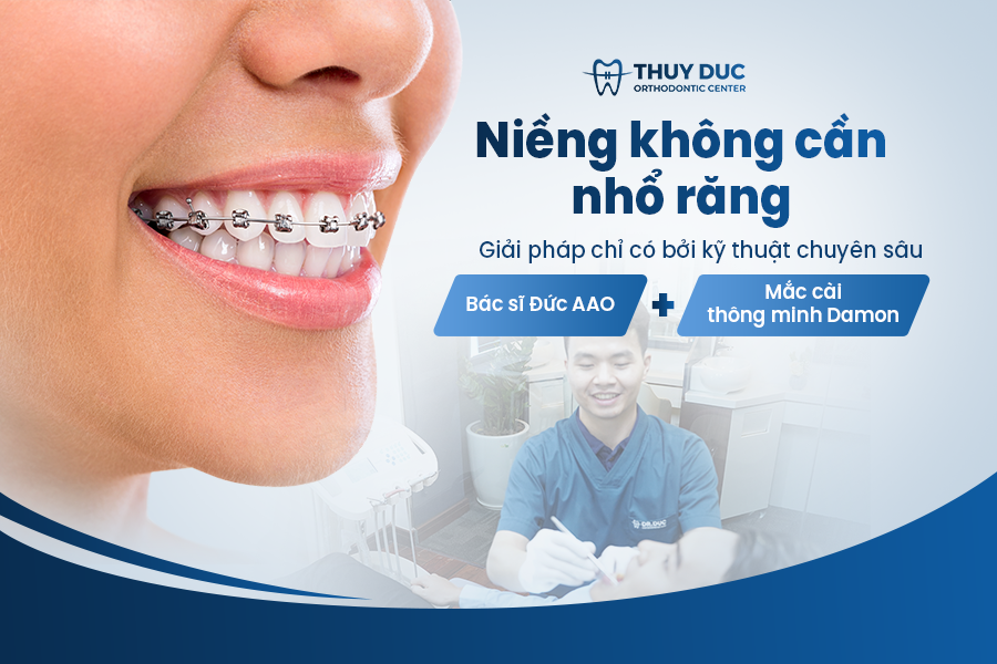 Niềng răng tại Nha khoa Thúy Đức có phải nhổ răng không? 2 Niềng răng tại Nha khoa Thúy Đức có phải nhổ răng không? 2