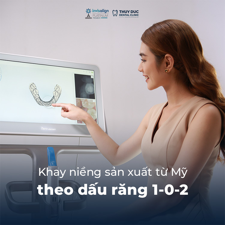 Chất lượng dịch vụ 1