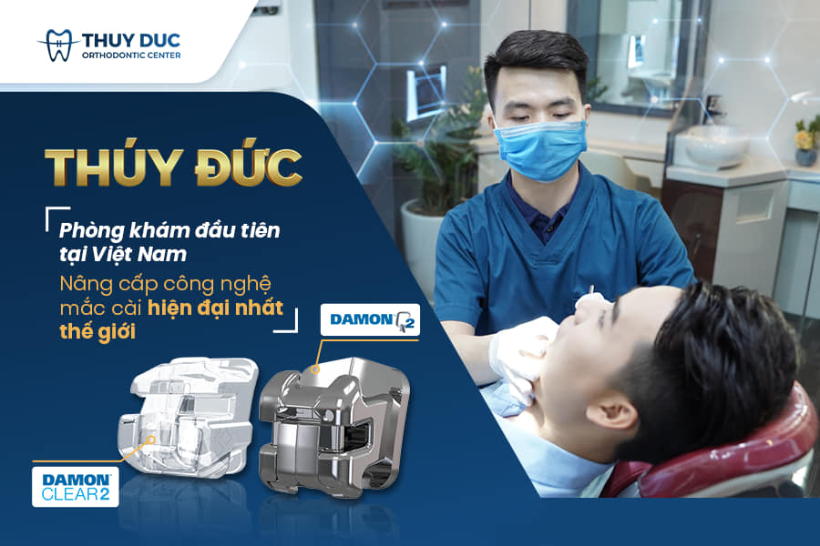 Duy trì chế độ ăn uống hợp lý sau khi niềng răng 1 Duy trì chế độ ăn uống hợp lý sau khi niềng răng 1