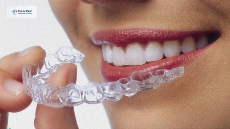 Niềng răng 3D Clear có đau không? 1