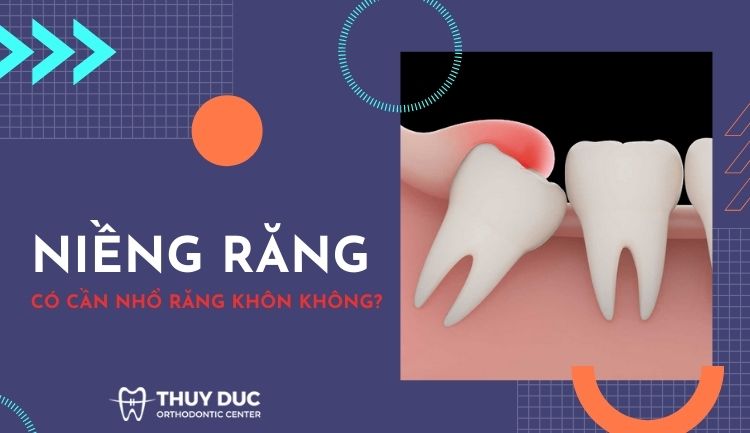 Niềng răng có cần nhổ răng khôn không? 1