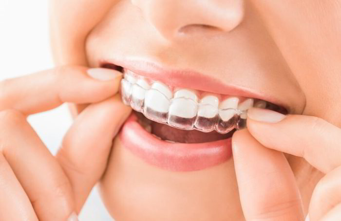 Điểm giống nhau 1