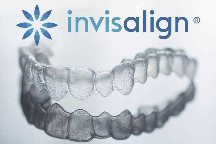 Niềng răng trong suốt Invisalign 1 Niềng răng trong suốt Invisalign 1