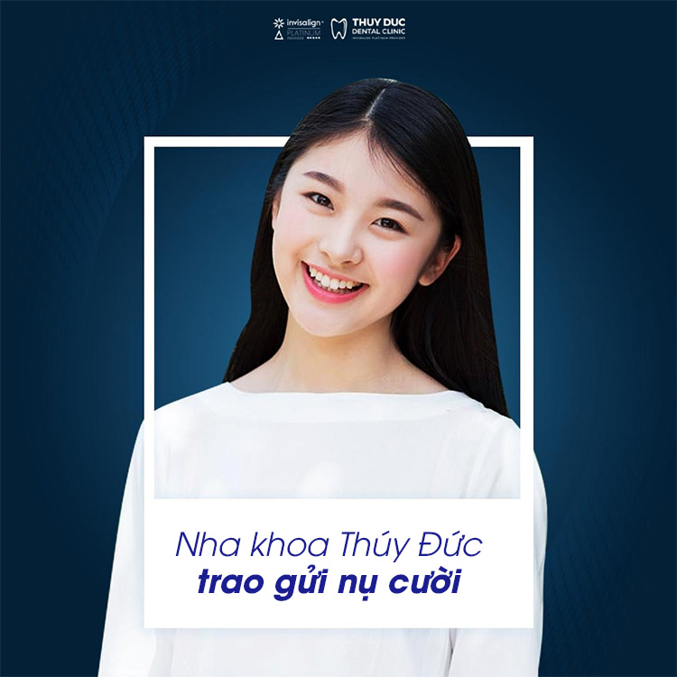 Niềng răng mang lại lợi ích về mặt thẩm mỹ cho khuôn mặt 1