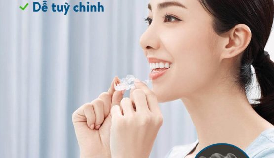 Niềng răng không sử dụng mắc cài hay còn có tên gọi khác là niềng răng trong suốt