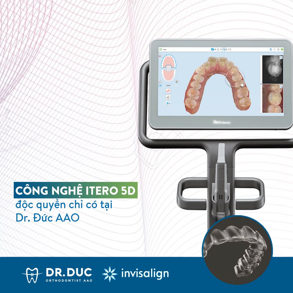 Nha khoa Thúy Đức - Địa chỉ niềng răng trong suốt Invisalign uy tín nhất tại Hà Nội 2 Nha khoa Thúy Đức - Địa chỉ niềng răng trong suốt Invisalign uy tín nhất tại Hà Nội 2