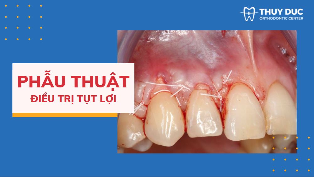 Cách xử lý trong trường hợp nghiêm trọng 1 Cách xử lý trong trường hợp nghiêm trọng 1