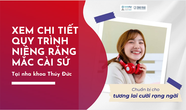 Niềng răng mắc cài sứ là gì? Quy trình thực hiện ra sao? 1 Niềng răng mắc cài sứ là gì? Quy trình thực hiện ra sao? 1