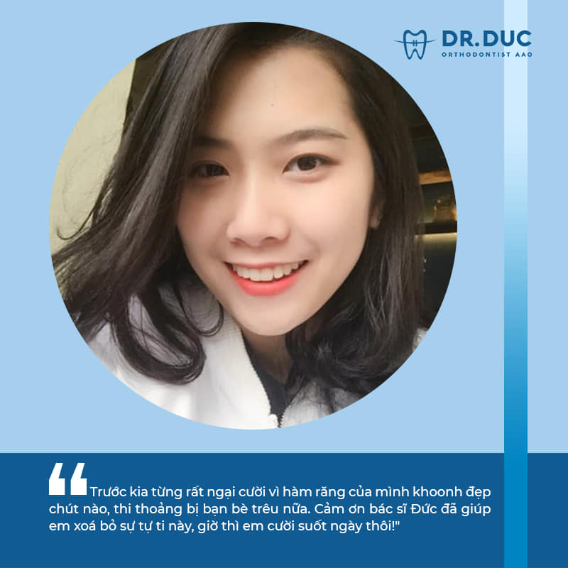 Niềng răng với mắc cài thông minh Damon Hoa Kỳ 12