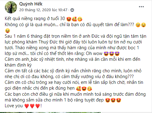 Niềng răng hô hàm dưới ở đâu tốt nhất? 1 Niềng răng hô hàm dưới ở đâu tốt nhất? 1