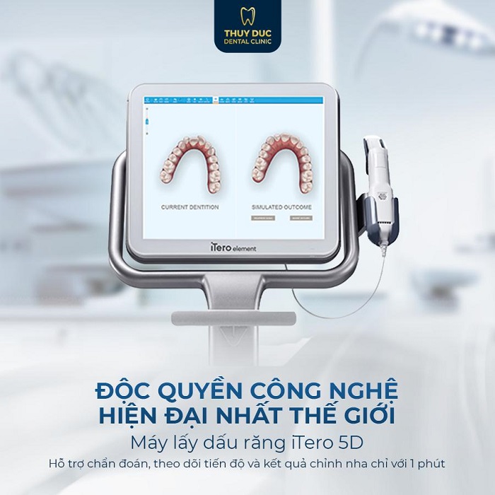 Địa chỉ niềng răng hô uy tín, an toàn tại đâu? 2 Địa chỉ niềng răng hô uy tín, an toàn tại đâu? 2