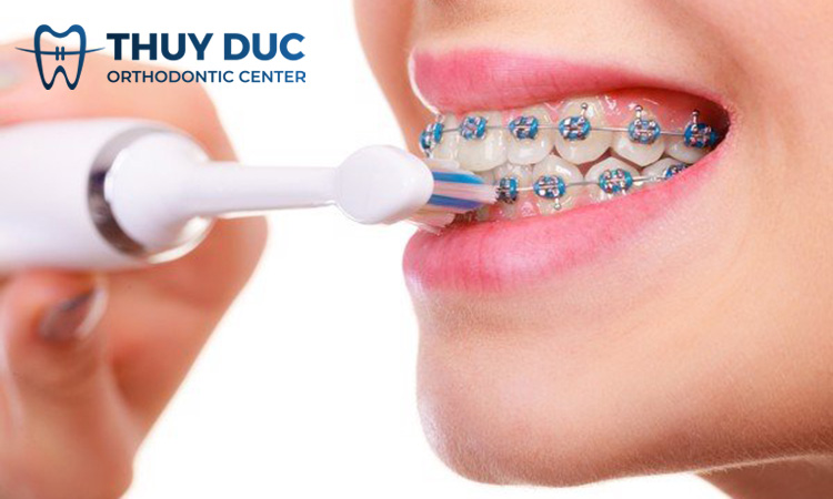 Lựa chọn bàn chải và kem đánh răng 1 Lựa chọn bàn chải và kem đánh răng 1