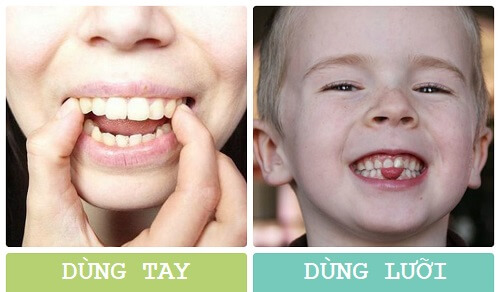 Tìm hiểu về các phương pháp làm răng giả phổ biến hiện nay
