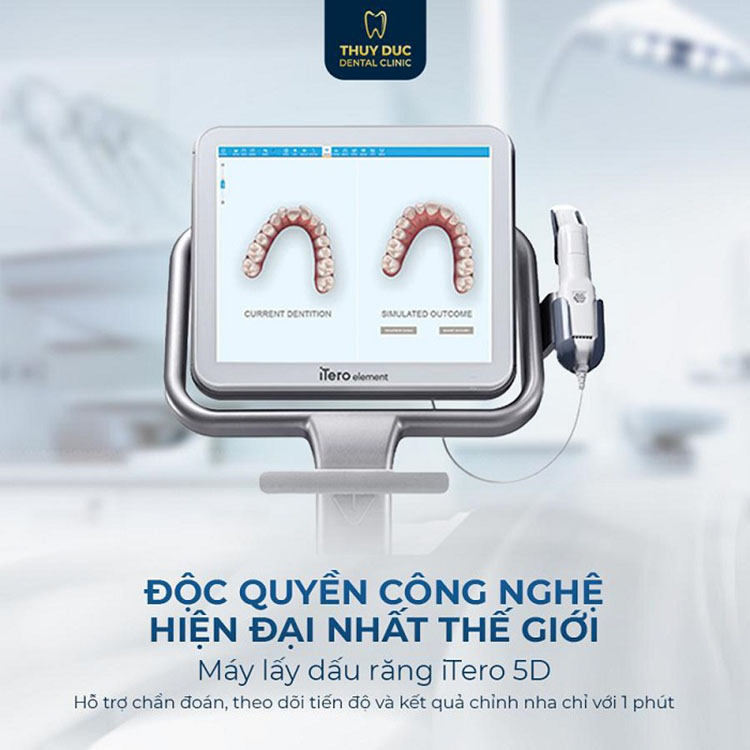 Tại sao bạn nên niềng răng hô tại nha khoa Thúy Đức? 1 Tại sao bạn nên niềng răng hô tại nha khoa Thúy Đức? 1