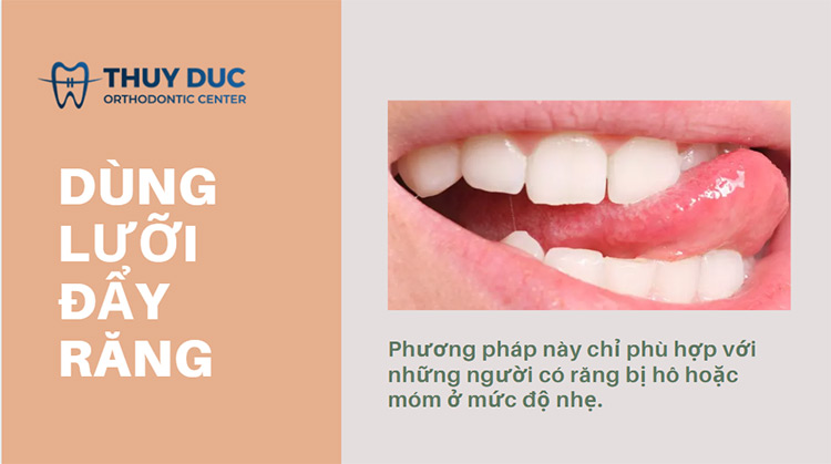 Dùng lưỡi để đẩy răng 1 Dùng lưỡi để đẩy răng 1