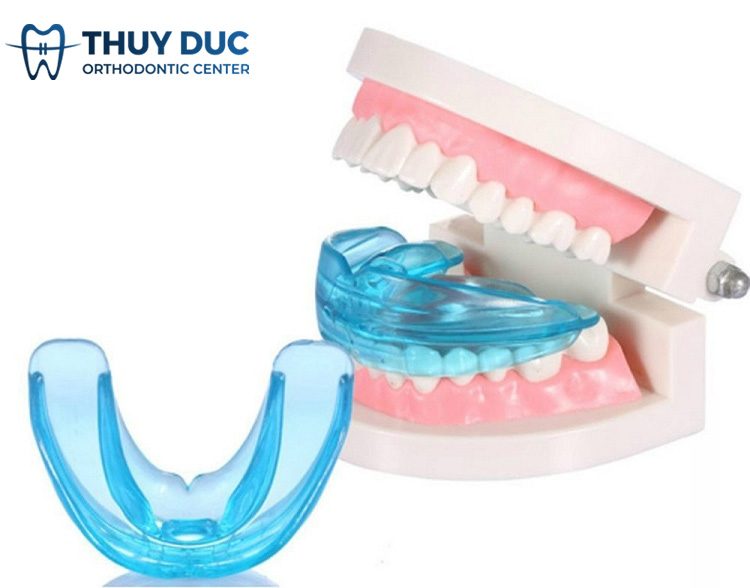 Thế nào là niềng răng Silicon? 1