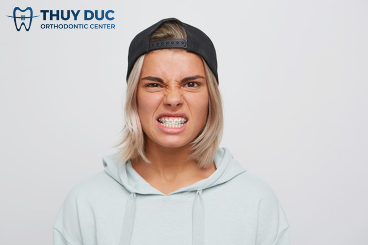 Kỹ thuật niềng răng chưa đảm bảo 1 Kỹ thuật niềng răng chưa đảm bảo 1