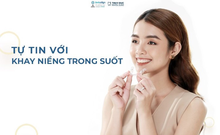 Niềng răng không mắc cài 1 Niềng răng không mắc cài 1