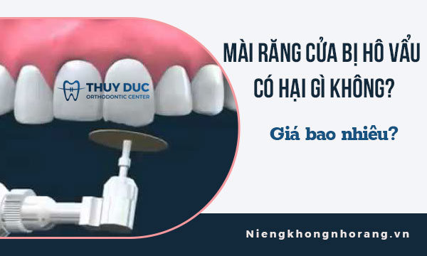 Phương pháp mài răng hô nhẹ như thế nào?
