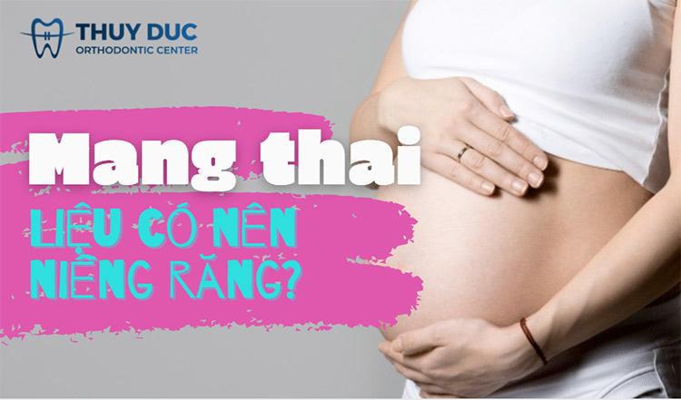 Mang thai có niềng răng được không? 1 Mang thai có niềng răng được không? 1
