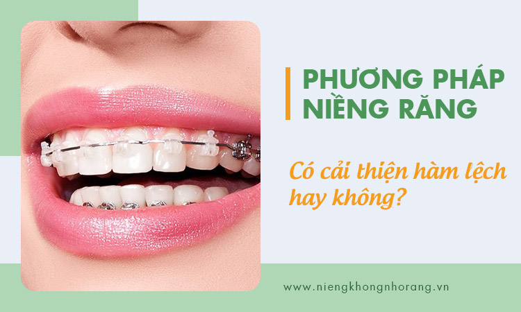 Tần suất điều chỉnh niềng răng có hết lệch mặt không 