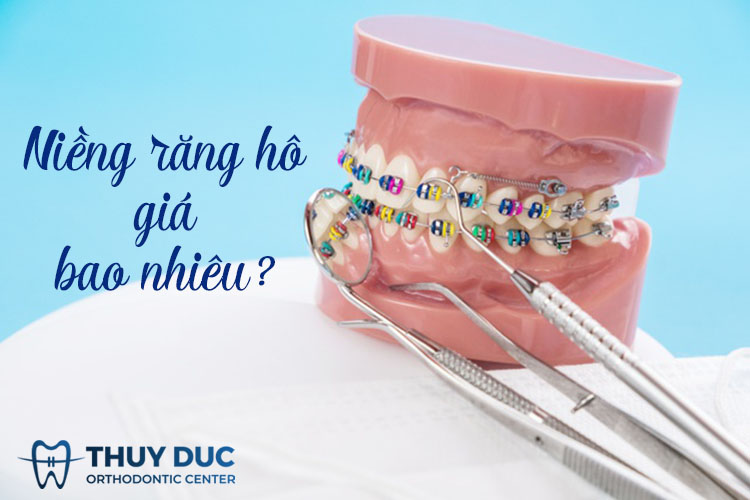 Chi phí niềng răng không mắc cài Invisalign 1 Chi phí niềng răng không mắc cài Invisalign 1