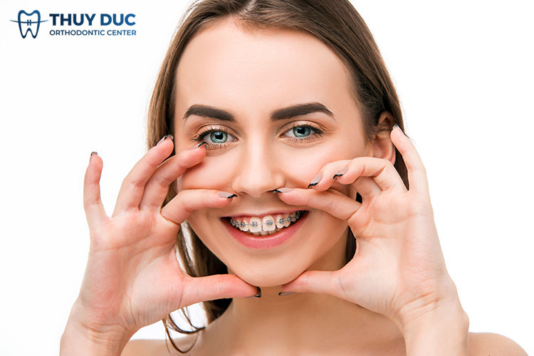 Răng hô nặng có niềng được hay không? 1 Răng hô nặng có niềng được hay không? 1