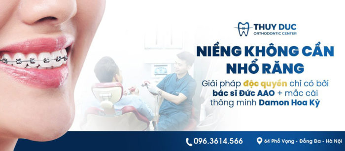 Niềng răng hô nhẹ không cần nhổ bởi Nha khoa Thúy Đức 1 Niềng răng hô nhẹ không cần nhổ bởi Nha khoa Thúy Đức 1