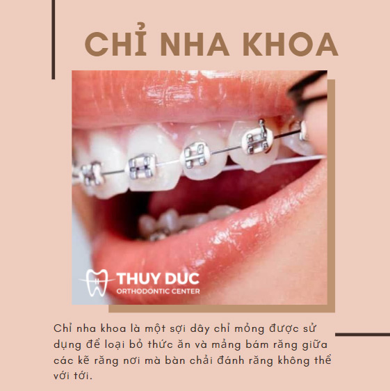 1. Chỉ nha khoa 1 1. Chỉ nha khoa 1