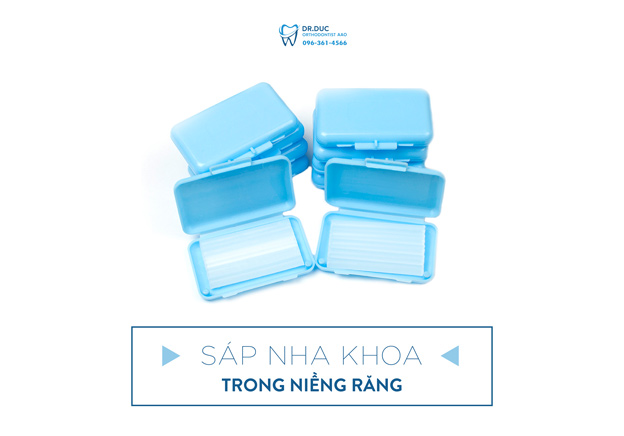 Hướng dẫn sử dụng sáp nha khoa trong niềng răng đúng cách 1 Hướng dẫn sử dụng sáp nha khoa trong niềng răng đúng cách 1