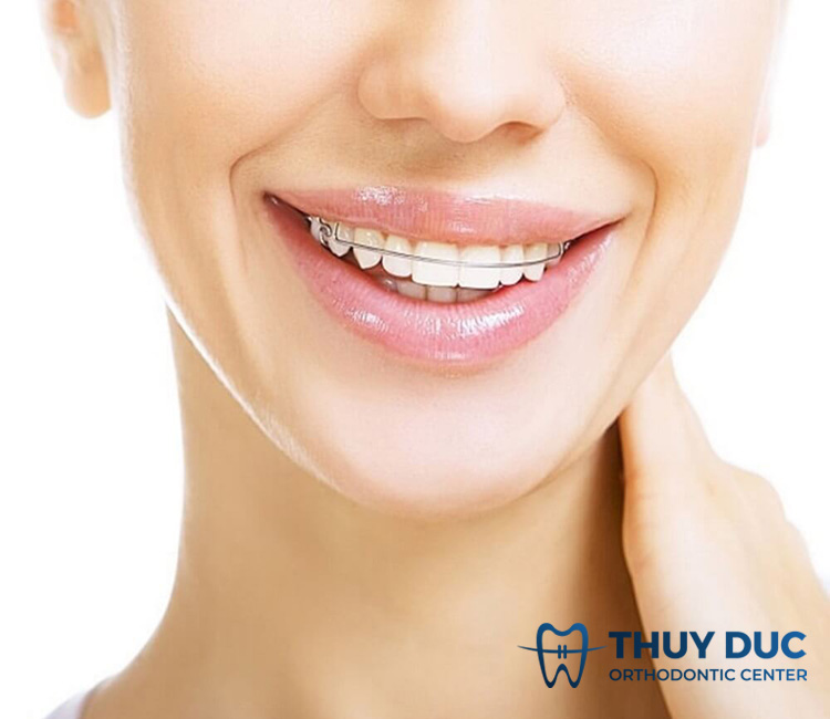 Hàm duy trì tháo lắp kim loại 1 Hàm duy trì tháo lắp kim loại 1