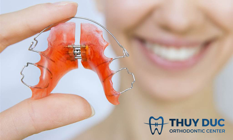 Hướng dẫn vệ sinh hàm duy trì 1 Hướng dẫn vệ sinh hàm duy trì 1