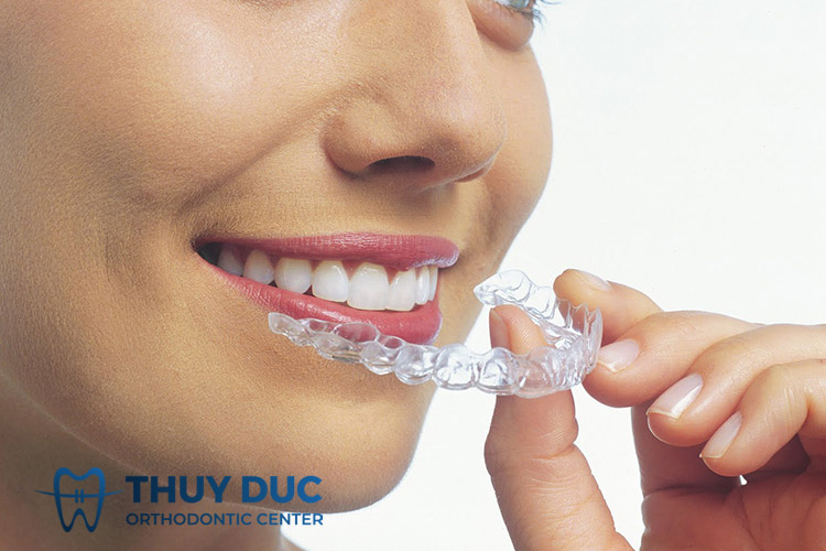 Dễ dàng tháo lắp 1 Dễ dàng tháo lắp 1