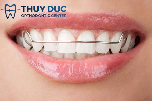 Tại sao bạn phải dùng hàm duy trì? 1