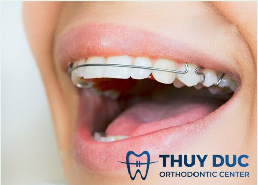 Hàm duy trì tháo lắp là gì? Có tác dụng như thế nào? 1