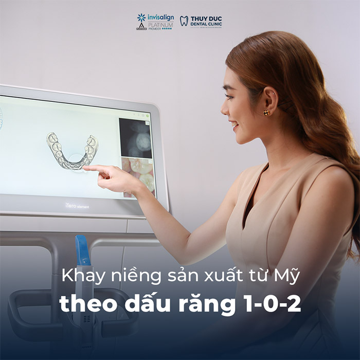 Chi phí niềng răng khấp khểnh bằng phương pháp niềng răng trong suốt Invisalign 1 Chi phí niềng răng khấp khểnh bằng phương pháp niềng răng trong suốt Invisalign 1