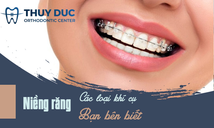 Các khí cụ thường gặp khi niềng răng bạn nên biết 1 Các khí cụ thường gặp khi niềng răng bạn nên biết 1