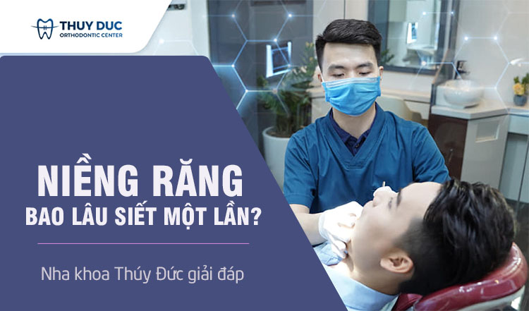 [Giải đáp] Niềng răng bao lâu siết một lần? 1