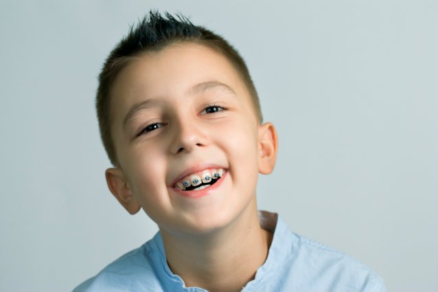 Niềng răng cho trẻ 10 tuổi cần lưu ý gì? - Nha khoa Thúy Đức