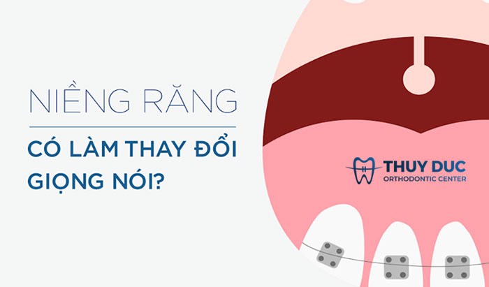 Niềng răng có ảnh hưởng tới giọng nói, phát âm không? 1
