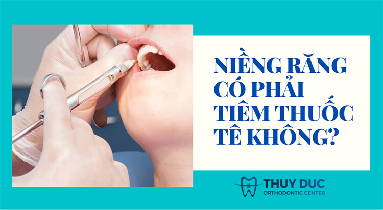 Niềng răng có tiêm thuốc tê không? 1